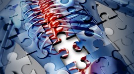 Surgery Outcomes Promising For Patients With Spinal Synovial Cysts