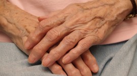Study Says Rheumatoid Arthritis Linked To Blood Clots: Overall Risk Is Small But Present