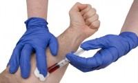 DNA Test Could Lead to Early Prostate Cancer Detection
