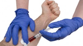 DNA Test Could Lead to Early Prostate Cancer Detection