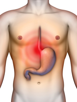 Everything You Need To Know About GERD