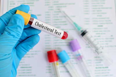 10 Need-to-Know Facts on Cholesterol